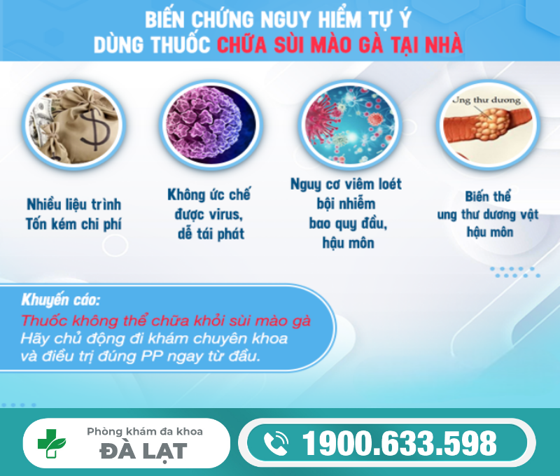 Hình ảnh minh họa